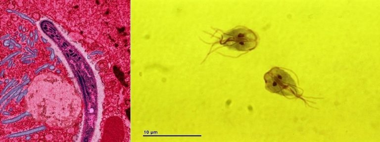 Microscopic photos of Plasmodium and Giardia