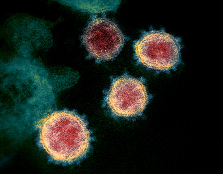 Close up image of SARS CoV-2, the Novel Coronavirus