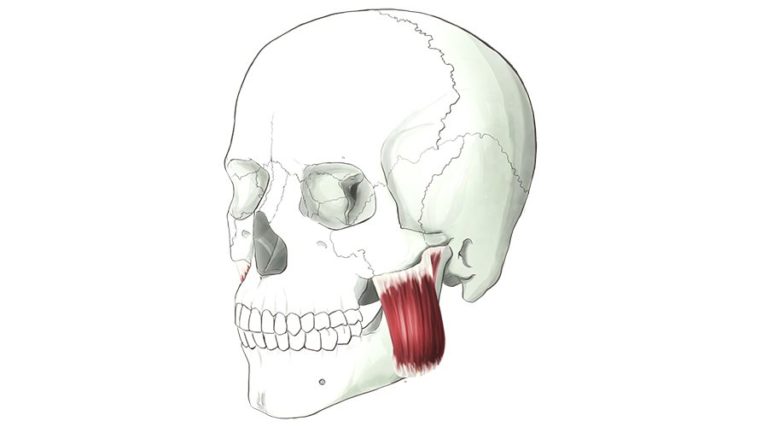 Masseter. A thick muscle that runs from the cheekbone to the lower jaw