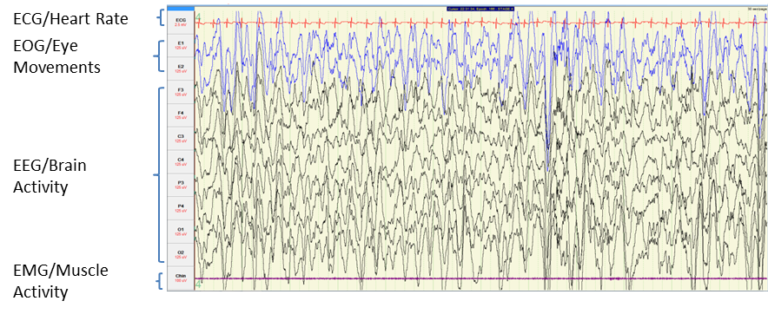 image of brain activity measurements during n3 sleep