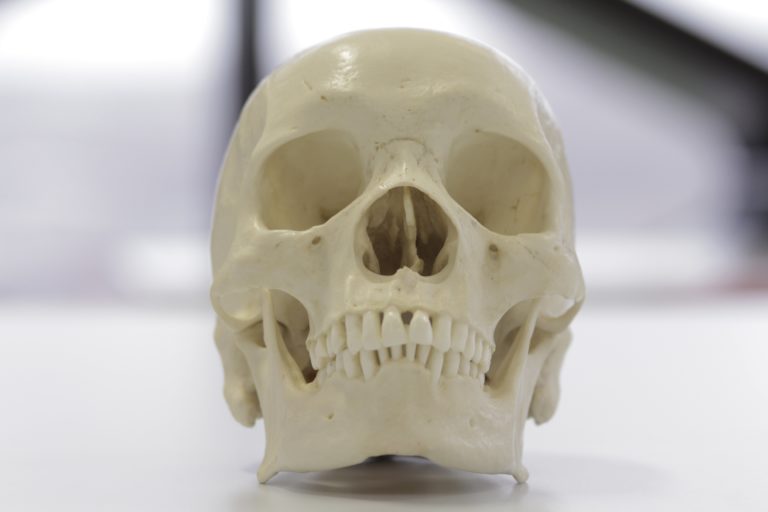 An African skull skull showing rectangular shaped orbits and wide nasal aperture