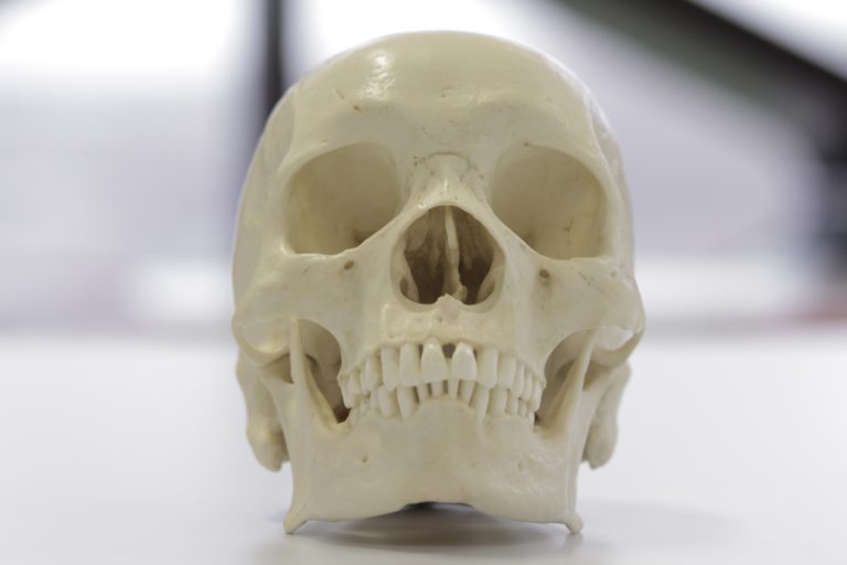 Identifying The Ethnicity Of A Skull