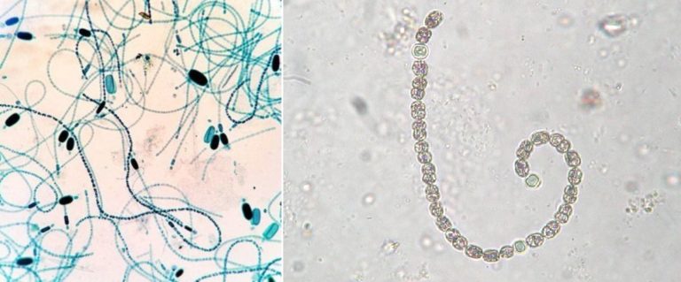 Left: Photomicrograph of cyanobacteria, Cylindrospermum. Right: Anabaena