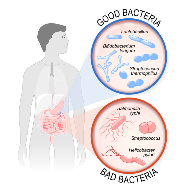 Diagram of a human with the gut highlighted. Arrow from the gut points to a circle labelled good bacteria containing: Lactobacillus, Streptococcus thermophilus, Bifidobacterium. Arrow from the gut points to a circle labelled bad bacteria containing: salmonella typhi, Streptococcus, Helicobacter pylori