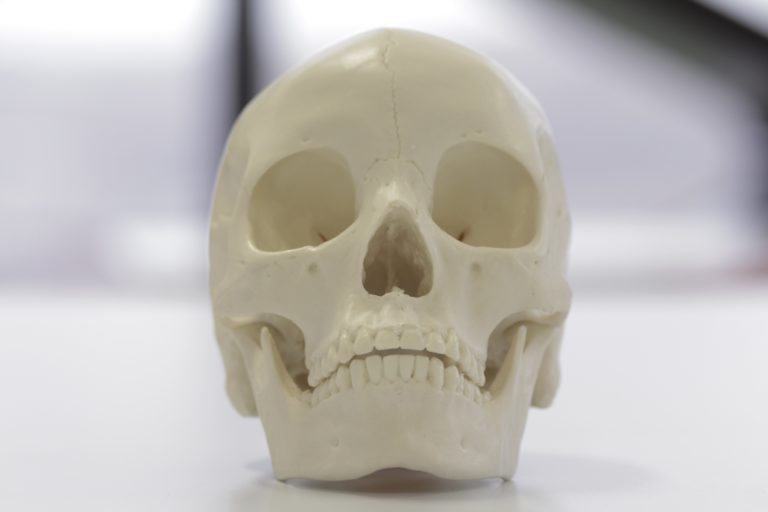 An Asian skull skull showing 'heart-shaped' nasal aperture