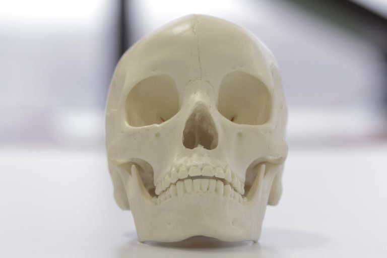 Identifying The Ethnicity Of A Skull