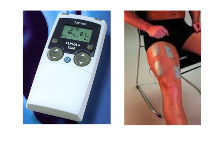 An NME device and electrodes attached to a leg.