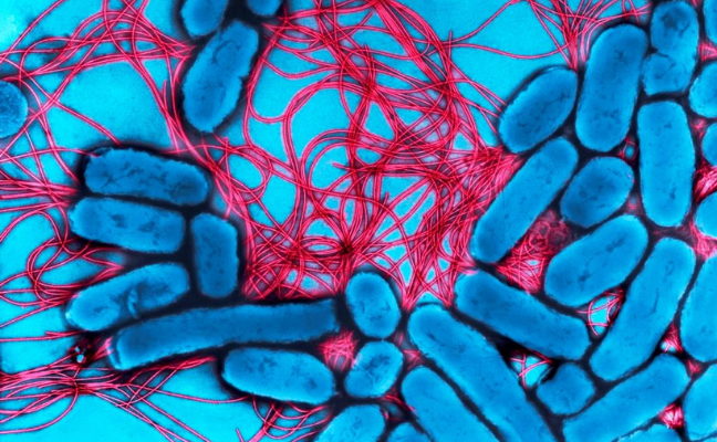 Close up, colourful image of Salmonella