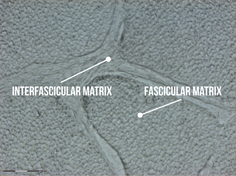 A microscopic image of horse tendon which shows the fascicular matrix (FM) and the interfascicular matrix