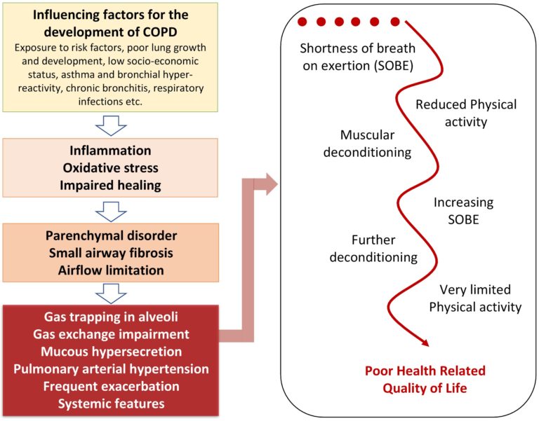Development and progression of COPD diagram