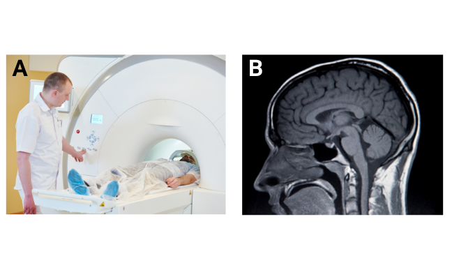 Image of man having an MRI scan