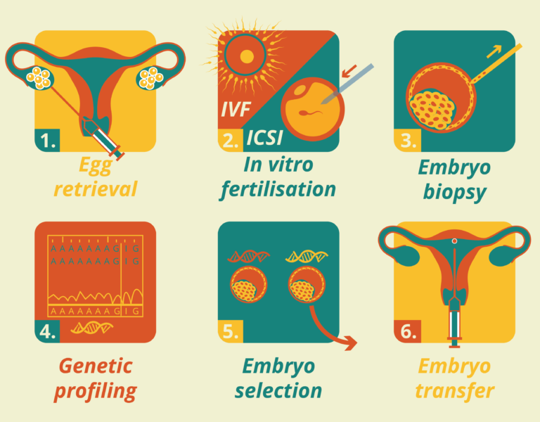 preimplantation genetic diagnosis