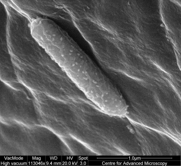 Close up of SEM image of Pseudomonas syringae