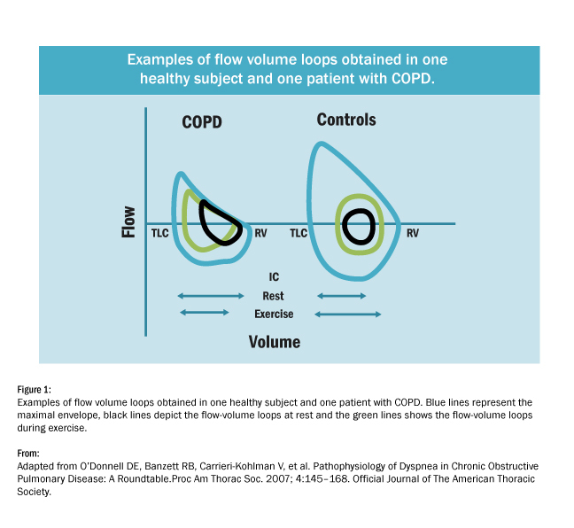 Chart comparing flow volume loops in lungs of healthy person and person with CPOD