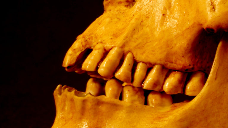 This is a replica of Mr. X’s skull showing that the surface of the molars had been ground away by repetitive chewing