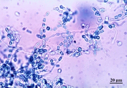 Coccidiodes immitis under microscrope