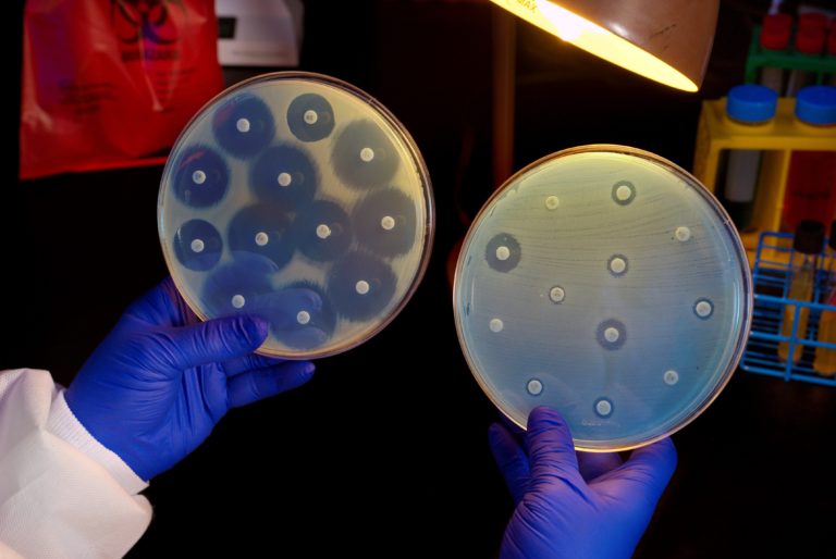 Hands with surgical gloves holding two petri dishes growing bacteria
