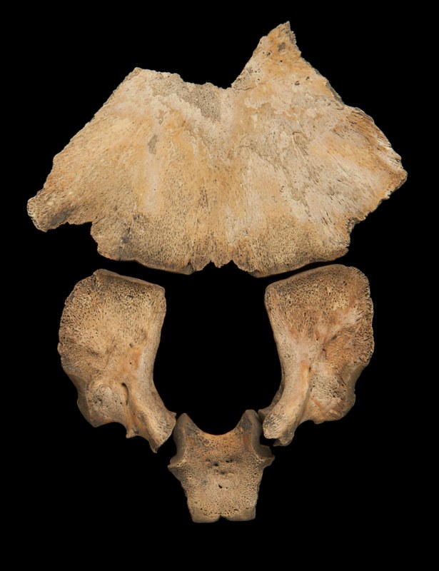 A normal non-adult occipital bone, displaying the separate pieces before fusion