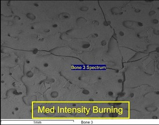 A scanning electron micrograph of bone that has been burned at medium intensity. The bone surface shows slightly bigger holes and larger fractures than at low intensity