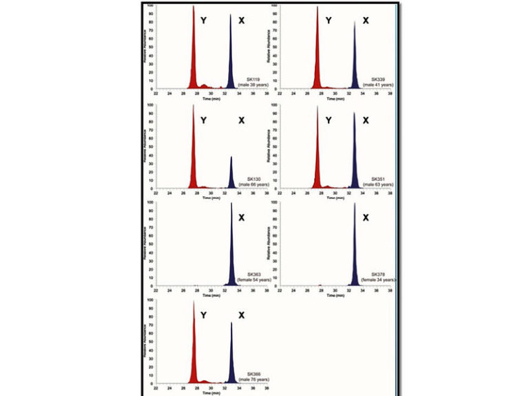 Using Peptides In Tooth Enamel To Determine Sex 