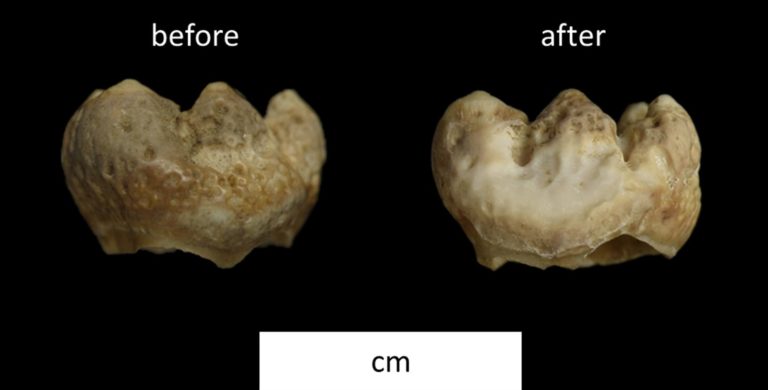 A before (left) and after (right) picture of a tooth that has been sampled. The only difference is a slight acid etch to the surface