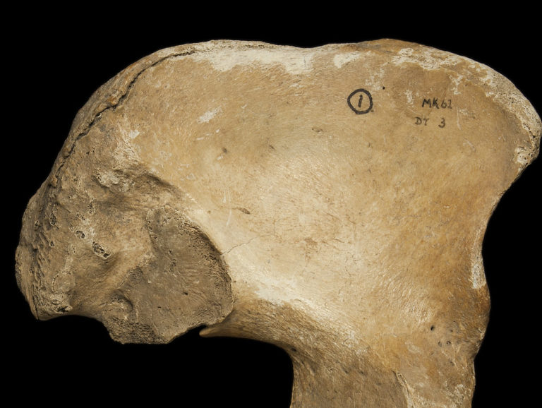 A pelvis presenting a young auricular surface. The texture is fine-grained and striae and some billows are present