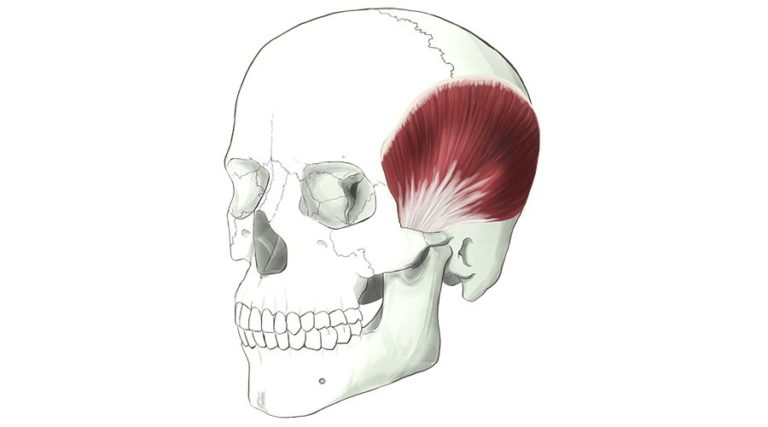 Temporalis. A fan shaped muscle that fills out the side of the head.