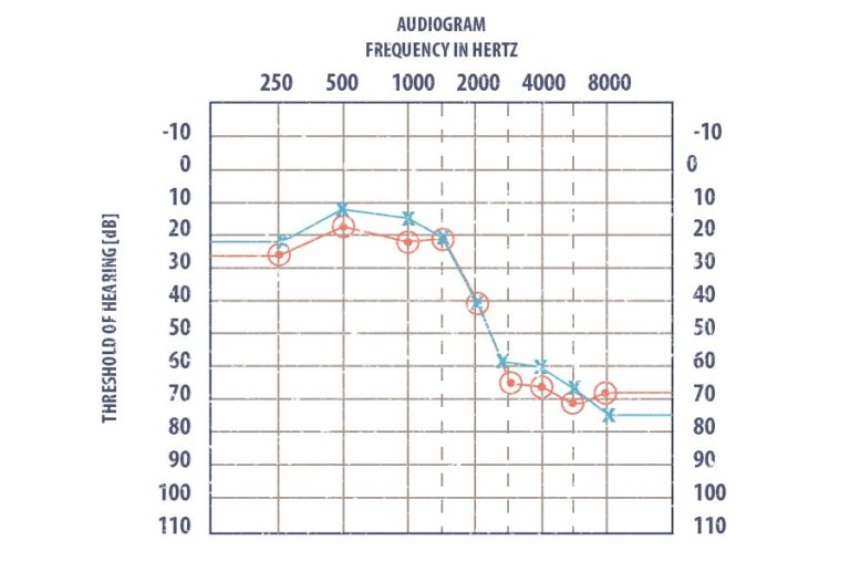 Audiogram table.jpg