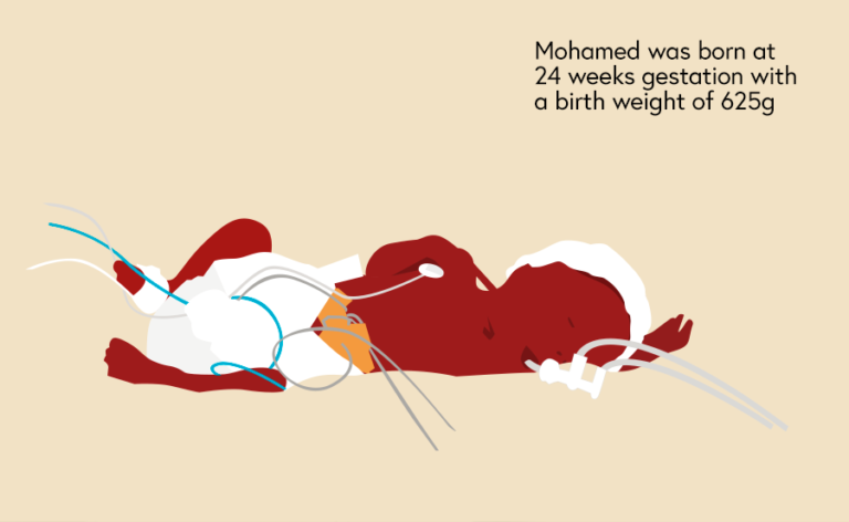 Illustration of baby Mohamed in his incubator not long after he was born