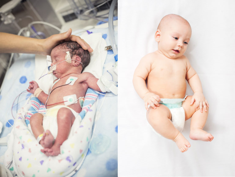 A premature baby is pictured on the left and a full term baby is pictured on the right