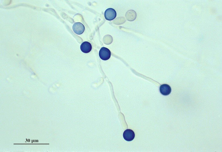 candida seen under the microscope using a blue stain