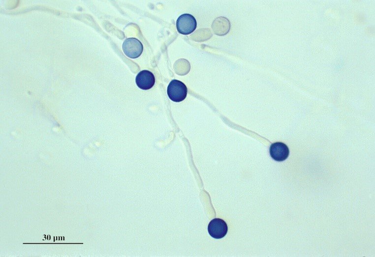 使用蓝色污渍在显微镜下看到的念珠菌