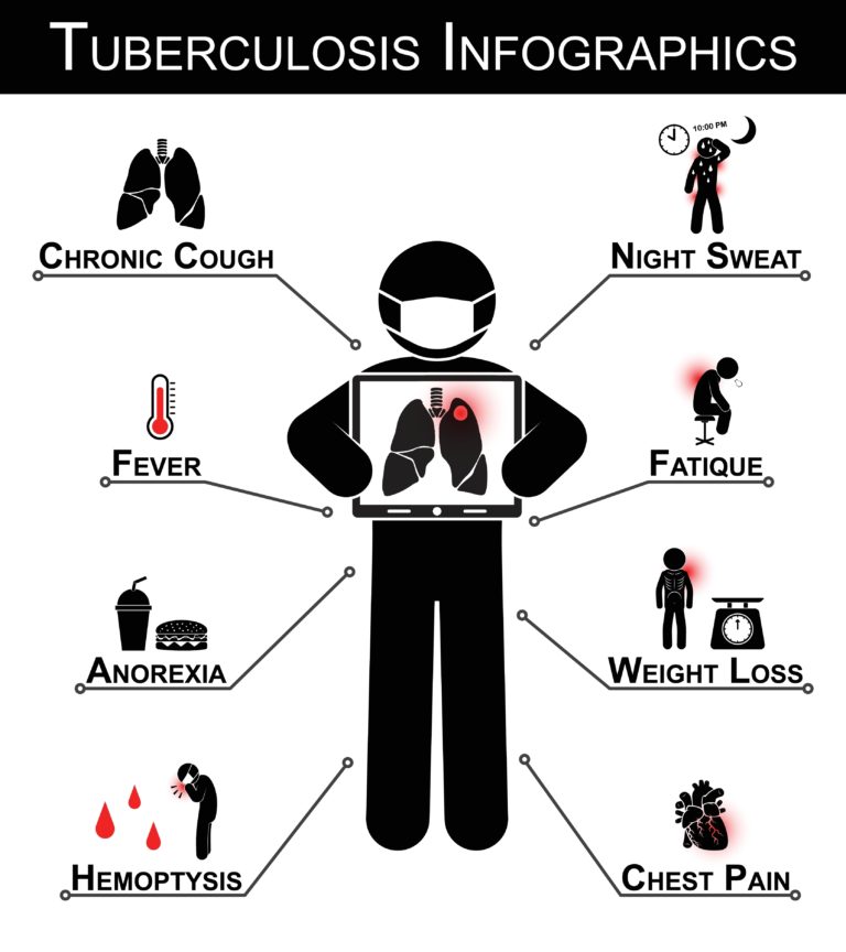 The main symptoms of Tuberculosis are: Chronic Cough, Fever, Anorexia, Hemoptysis, Night sweat, Fatigue, Weight Loss