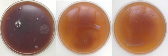 bacteria growing in agar