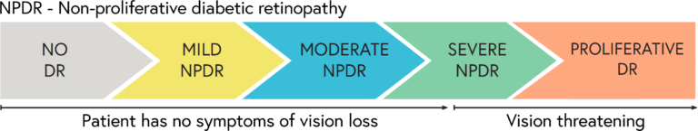 DR progresses through mild and moderate stages before becoming vision threatening in its severe and proliferative stages