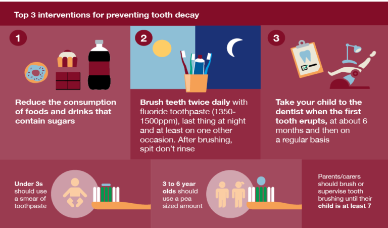 Infographic showing top 3 ways to limit tooth decay - reducing consumption of sugary food and drinks, brush teeth twice daily, and take child to dentist when firts tooth erupts, then at 6 months, then on regular basis.