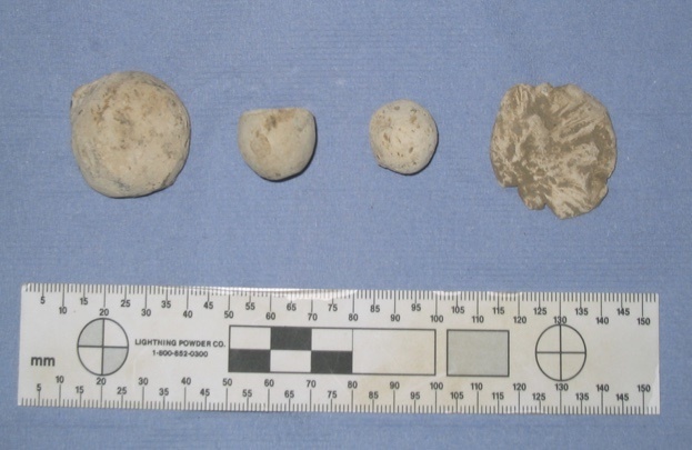 Photo illustrating the size of musket balls found at culloden