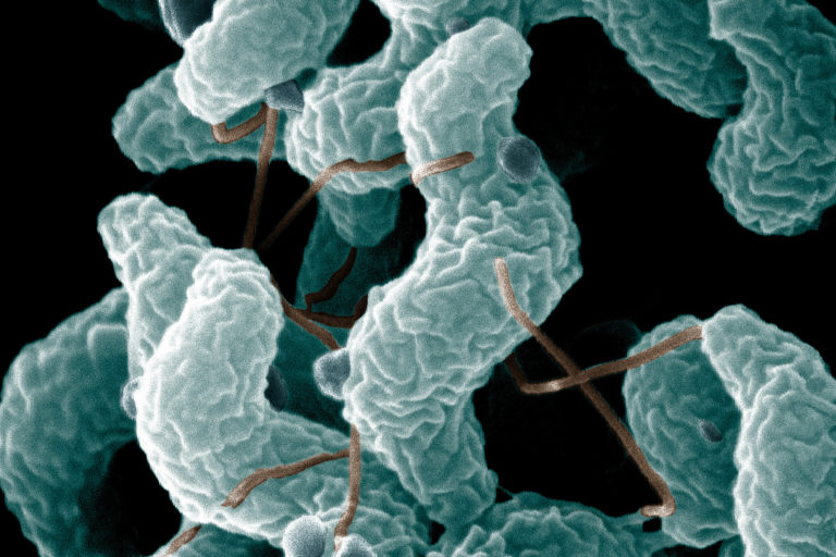 a microscopic image of campylobacter