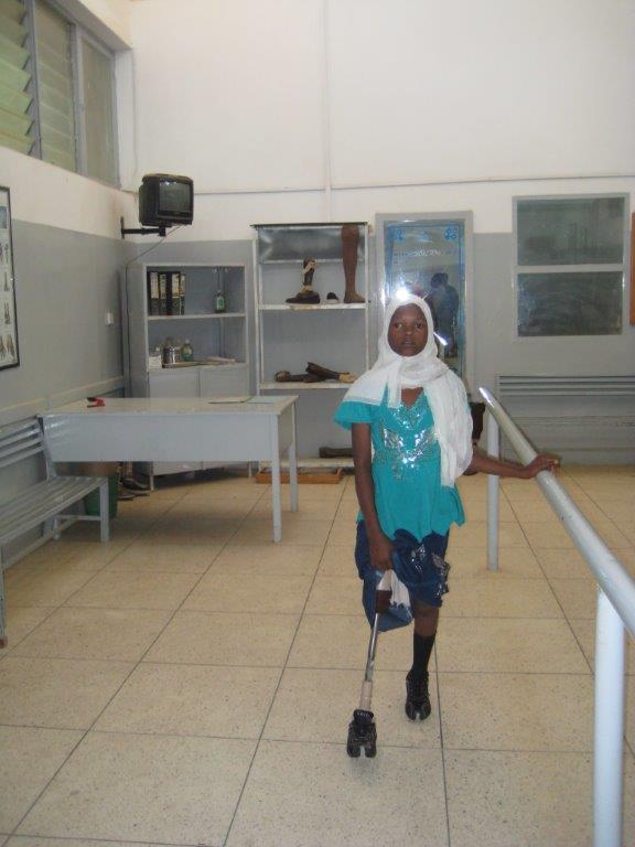 Girl walking with prostetic limb