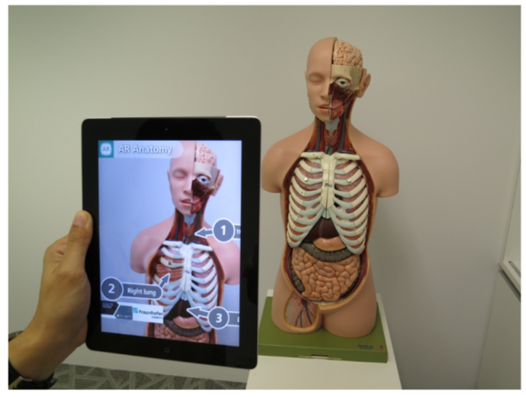 Augmented reality medical 3D