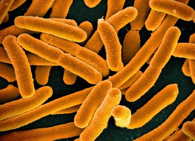 Microscopic photo or E coli. bacteria is orange and rod shaped