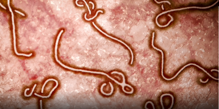 Image of Ebola Virus