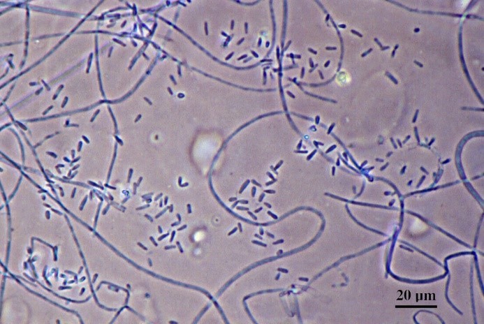 Trichophyton verrucosum under the microscope