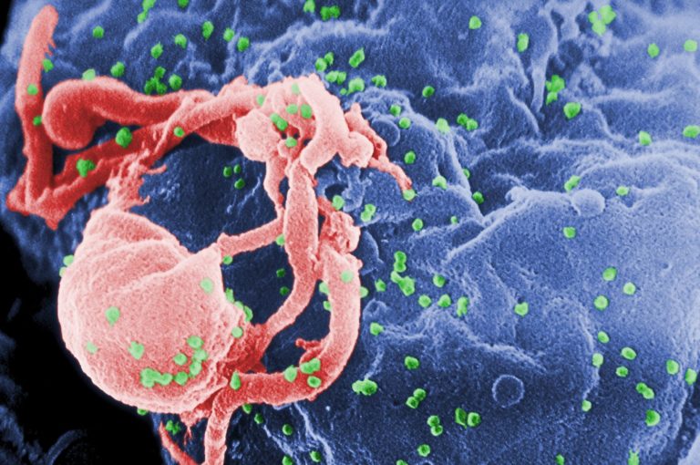 Scanning electron micrograph of HIV-1 budding (in green) from cultured lymphocyte