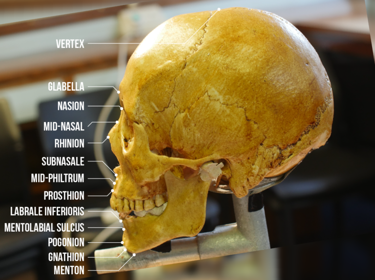 Image: The points at which the osteometric markers are placed