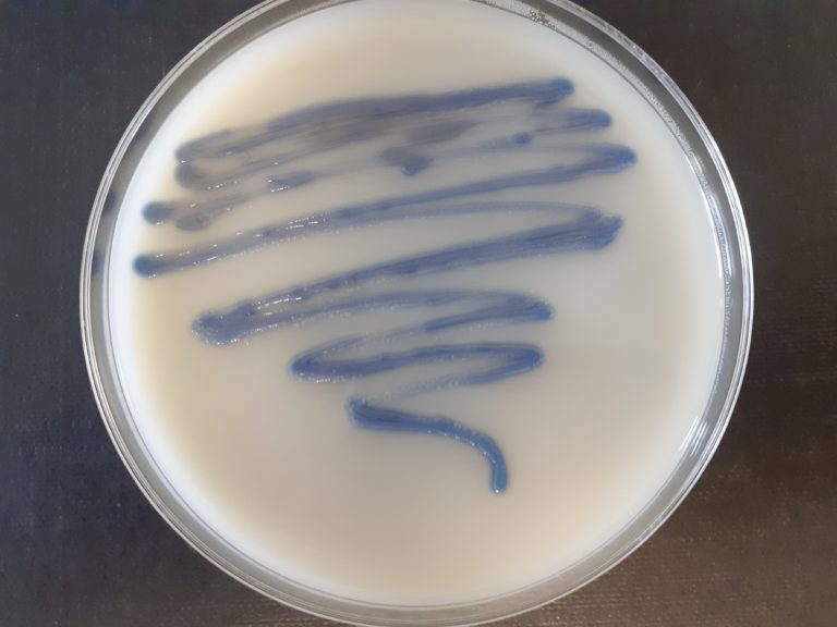 MRSA plate