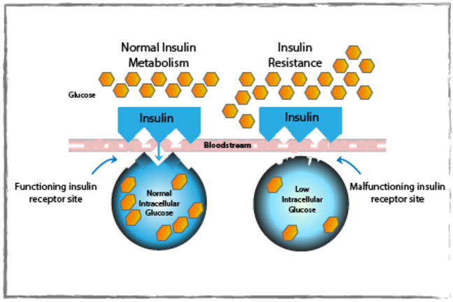 Insulin resistance through malfunctioning insulin receptor site.