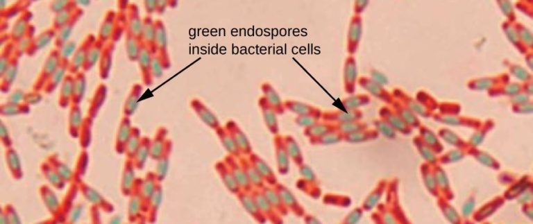Bacillus cells. Green-stained endospores are visible inside many of the vegetative cells, which have been counterstained with a pink dye. A few spores can also be seen outside the cells