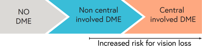 Increasing risk of vision loss from DME as it progresses to central-involved DME