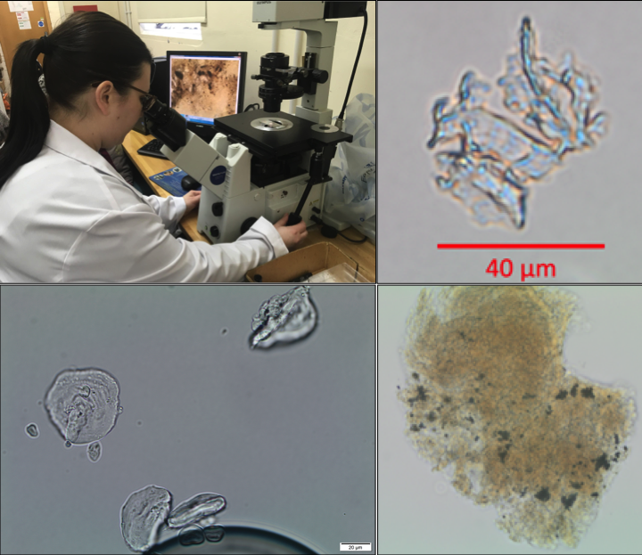 Photos showing: Lisa Mackenzie analysing microscopic particles; heavily boiled plant epidermis; damaged starch granules; traces of microcharcoal or soot in dental calculus